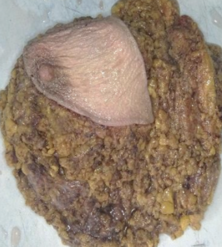 Description of the image